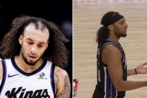 太“秃”然了！互联网的评论让德文-卡特戴上了发带！